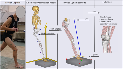 Subject-specific lower limb modeling and evaluation with a force-dependent kinematics natural knee model